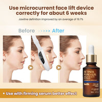 Microcurrent Facial Massager for At-Home Skincare